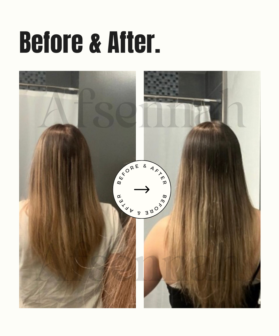 Custom Hair Growth Scalp Treatment