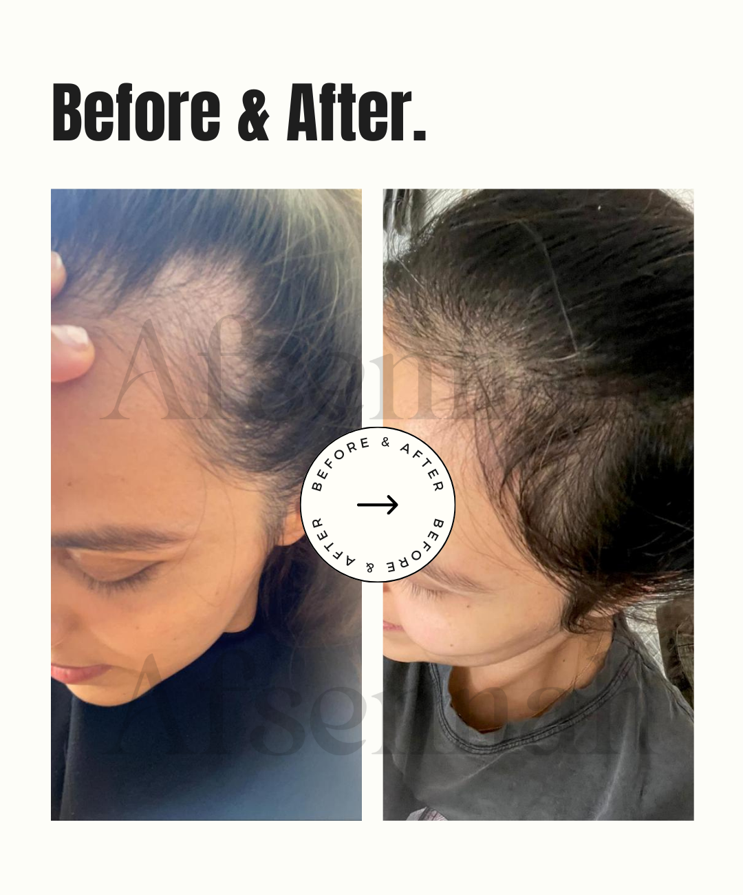 Custom Hair Growth Scalp Treatment
